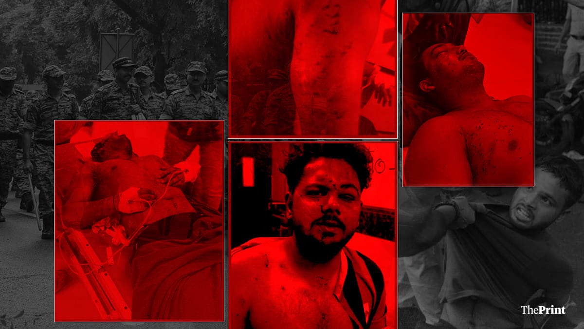 Pellet Injuries Reported During Delhi Protests