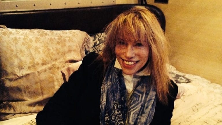 1980s hit singer Carly Simon shares Parkinson’s diagnosis. Her new album comes out in August