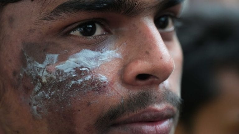 Fractures, blood clots, head injuries: Inside Delhi hospitals after lathicharge at CJP march