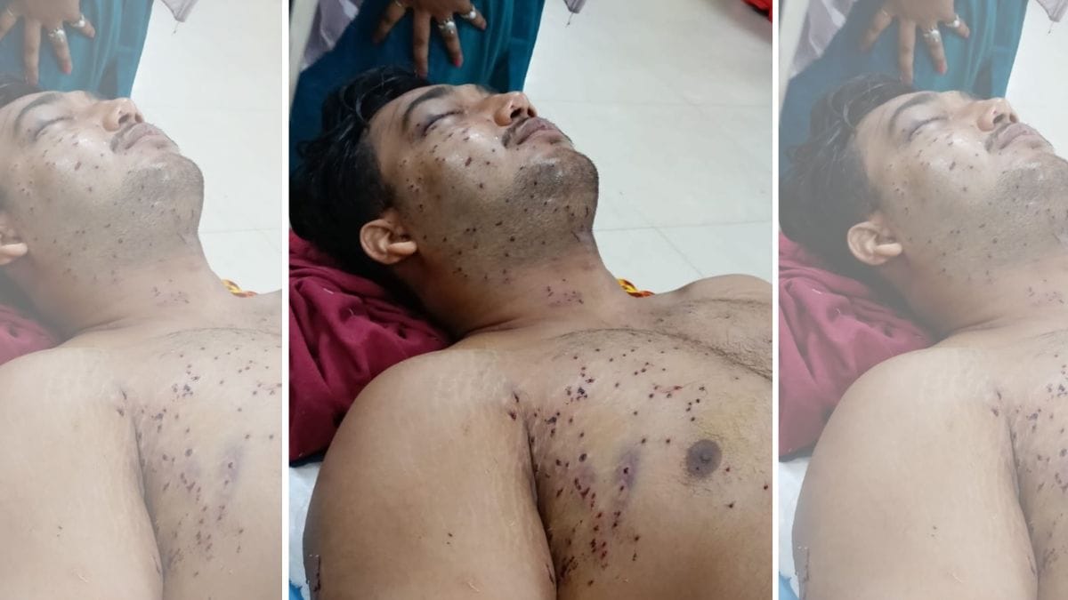 Sahil Lochab, admitted in AIIMS Trauma Centre | By special arrangement