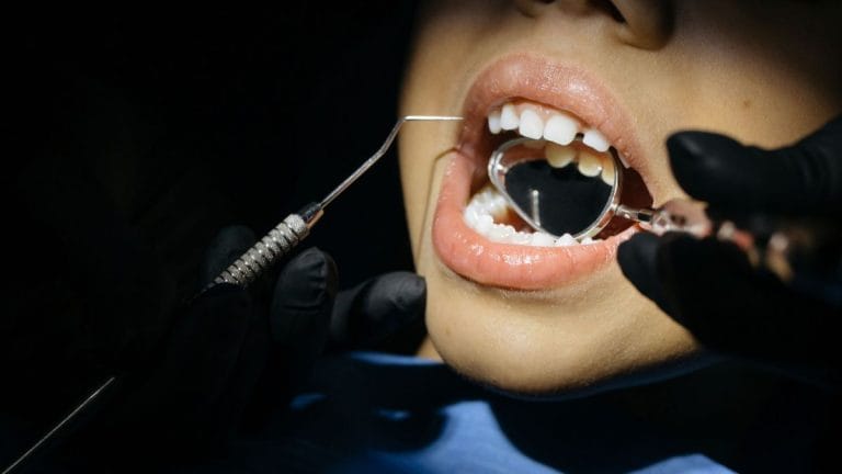 Treating cavities may no longer need drilling and filling. A silver and fluorine solution might do