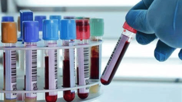 A parliamentary committee has recommended that the health ministry establish a national statutory body to set and enforce caps on essential procedures and diagnostics | Representational image
