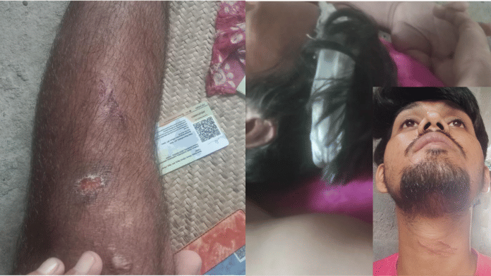 Abdul Hafiz says he was also attacked during the incident. | Special arrangement