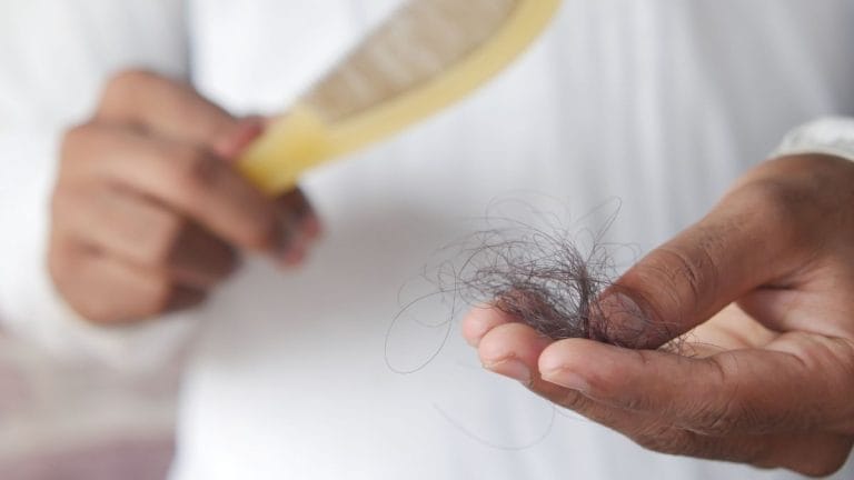 Arthritis drugs helps hair loss patients regrow 80% of hair, find 2 clinical trials