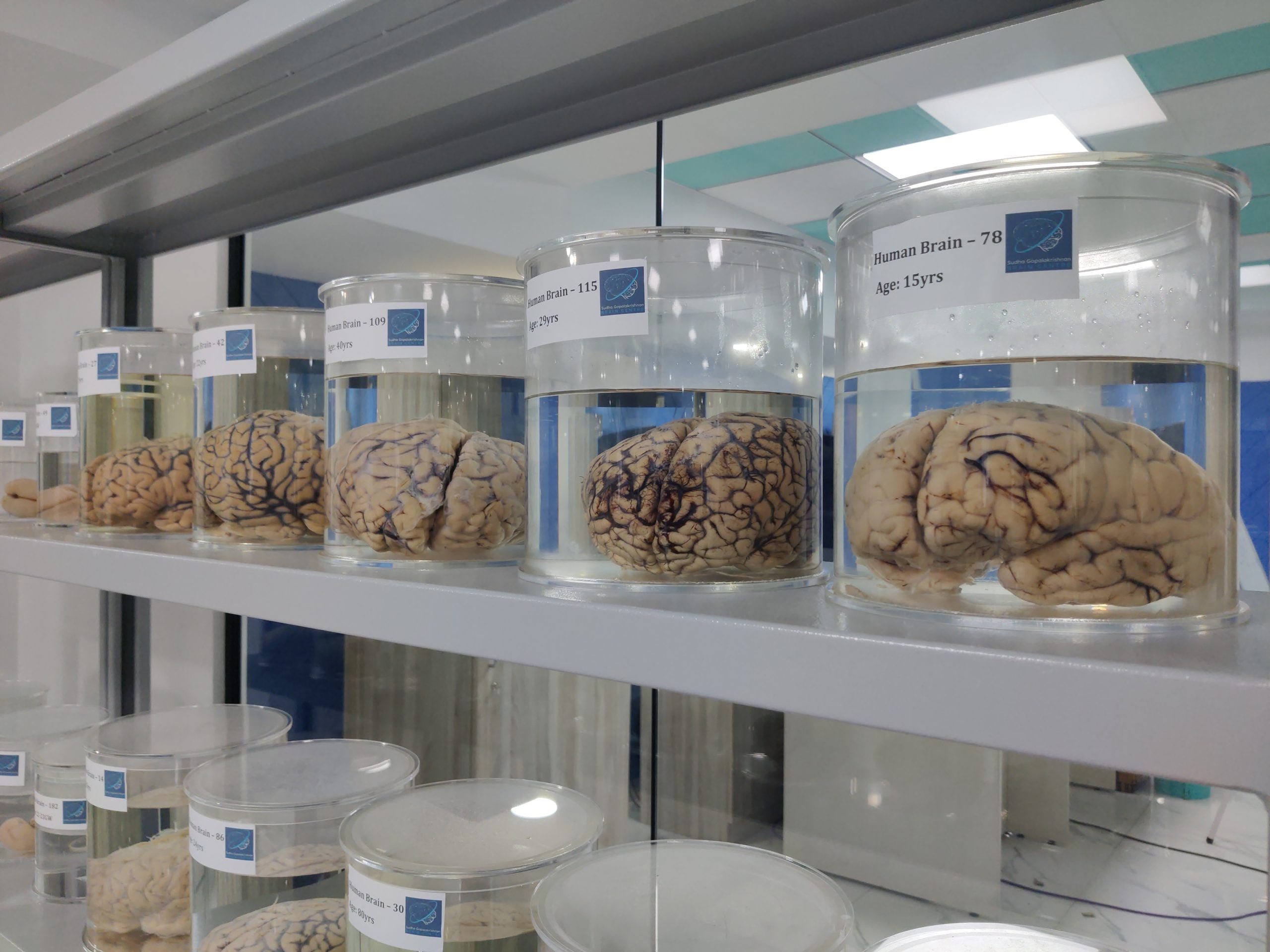 Each jar carries the centre’s logo, a number and the donor’s age, such as 'Human Brain – 78, Age: 15 yrs'. The brains are examined after death, as cell-level mapping needs tissue | Sneha Richhariya | ThePrint