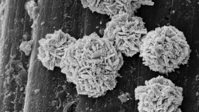Electron microscopic image of the catalyst: The spherical structures resemble desert roses and consist of tiny gold platelets 