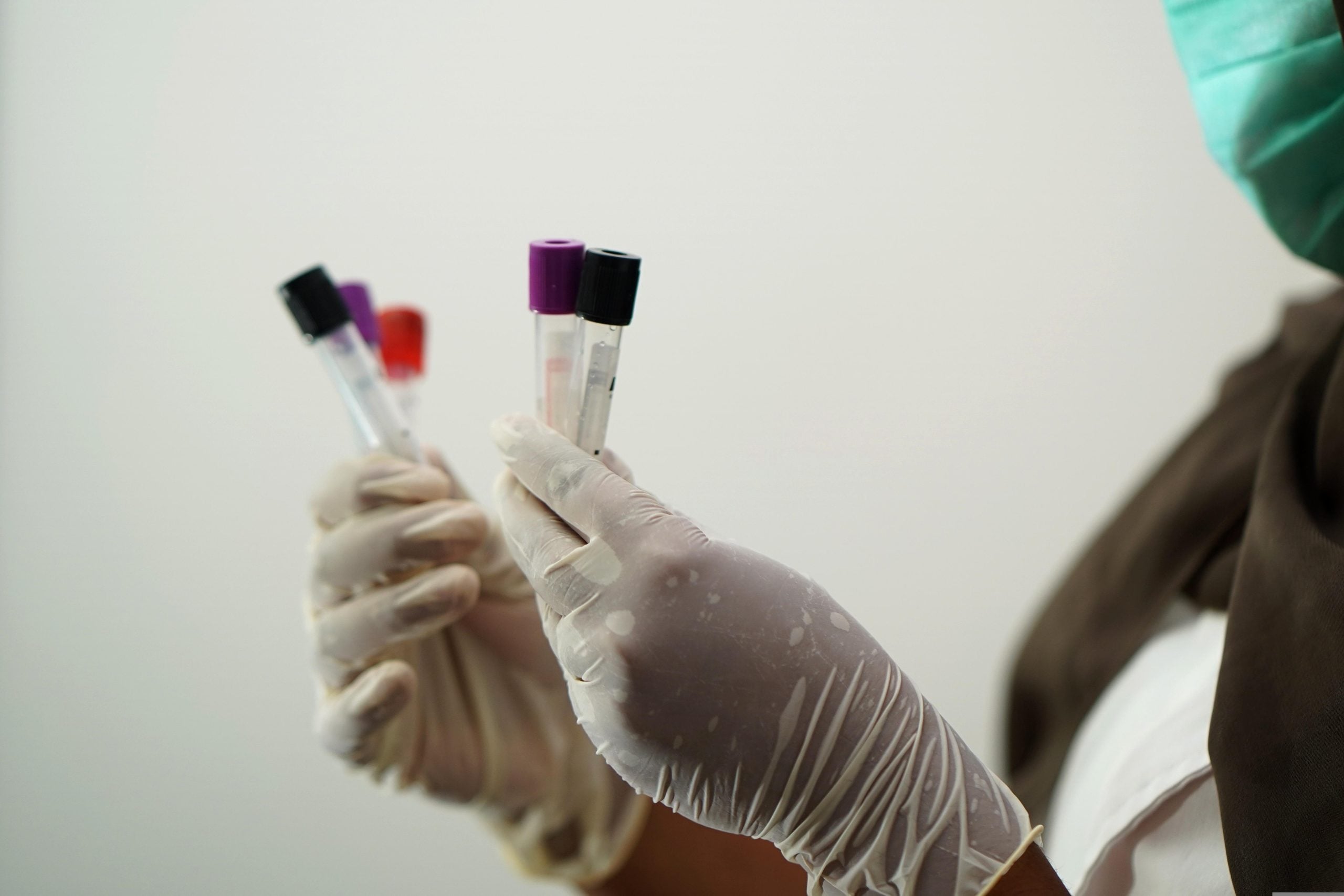 Siberian Anti-Plague Institute Draws Scrutiny After Employee’s Death